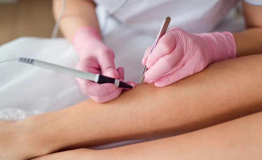 [zerkaloepil] Электроэпиляция в идеальном исполнен_0.png